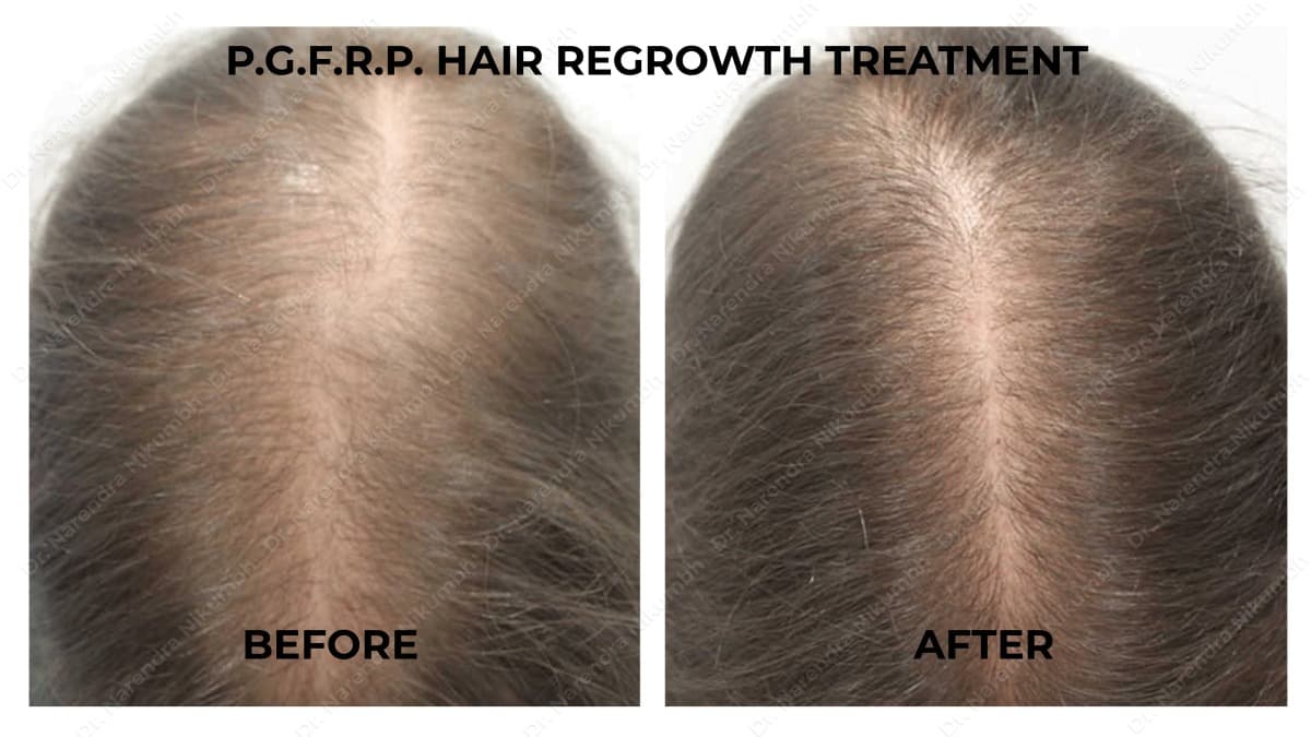 8-Dr-Narendra-Nikumbh-Best-Dermatologist-in-Thane